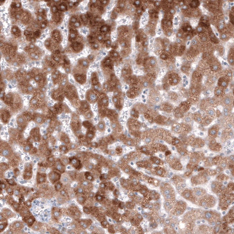 Immunohistochemistry (Formalin/PFA-fixed paraffin-embedded sections) - Anti-HMGCR Antibody [CL0259] (AB327101)