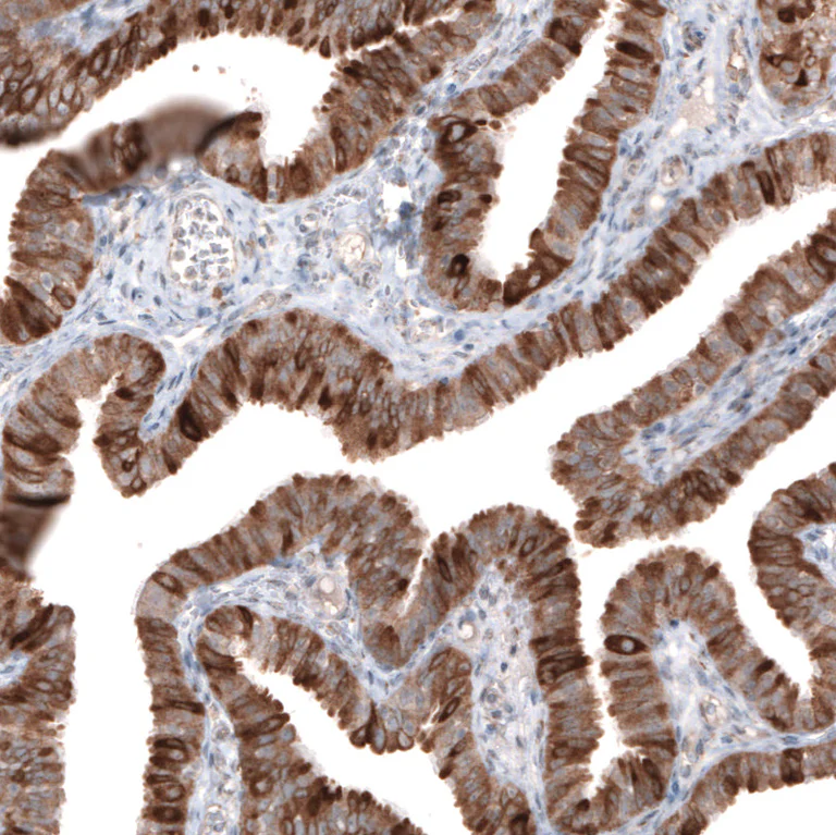 Immunohistochemistry (Formalin/PFA-fixed paraffin-embedded sections) - Anti-HMGCR Antibody [CL0259] (AB327101)