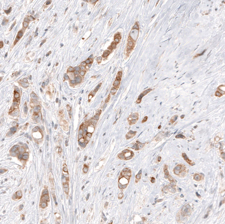 Immunohistochemistry (Formalin/PFA-fixed paraffin-embedded sections) - Anti-HMGCR Antibody [CL0259] (AB327101)