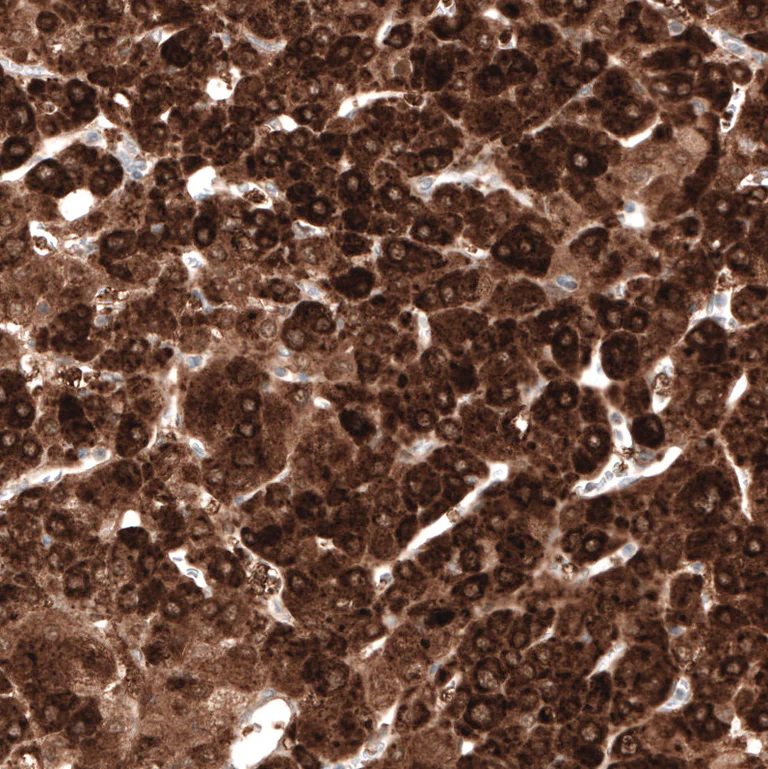 Immunohistochemistry (Formalin/PFA-fixed paraffin-embedded sections) - Anti-HMGCR Antibody [CL0259] (AB327101)