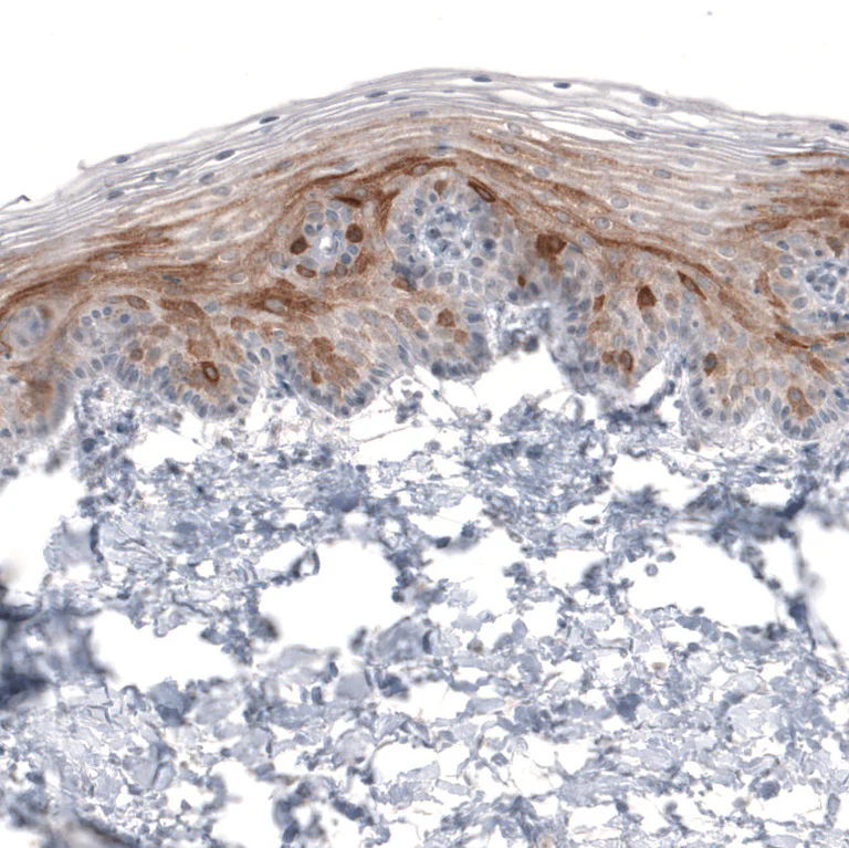 Immunohistochemistry (Formalin/PFA-fixed paraffin-embedded sections) - Anti-HMGCR Antibody [CL0259] (AB327101)