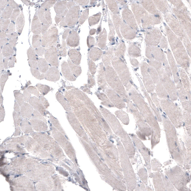 Immunohistochemistry (Formalin/PFA-fixed paraffin-embedded sections) - Anti-HMGCR Antibody [CL0259] (AB327101)