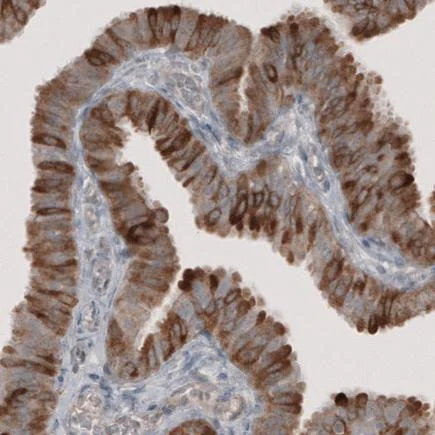 Immunohistochemistry (Formalin/PFA-fixed paraffin-embedded sections) - Anti-HMGCR antibody [CL0260] (AB242315)