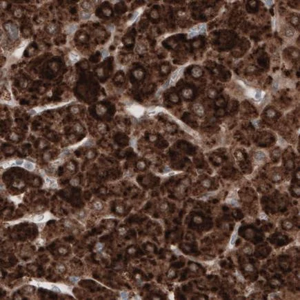 Immunohistochemistry (Formalin/PFA-fixed paraffin-embedded sections) - Anti-HMGCR antibody [CL0260] (AB242315)