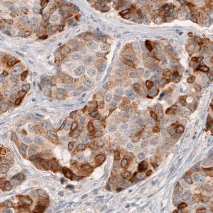 Immunohistochemistry (Formalin/PFA-fixed paraffin-embedded sections) - Anti-HMGCR antibody [CL0260] (AB242315)