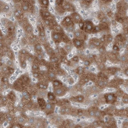 Immunohistochemistry (Formalin/PFA-fixed paraffin-embedded sections) - Anti-HMGCR antibody [CL0260] (AB242315)