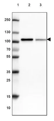 Western blot - Anti-HMGCR antibody [CL0260] (AB242315)