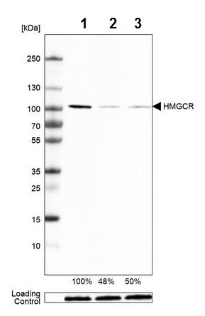 Western blot - Anti-HMGCR antibody [CL0260] (AB242315)