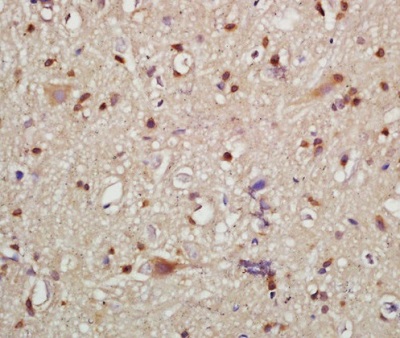 Immunohistochemistry (Formalin/PFA-fixed paraffin-embedded sections) - Anti-HMGCR (phospho S872) antibody (AB215437), expandable thumbnail