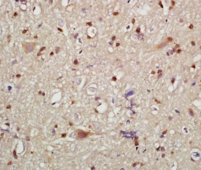 Immunohistochemistry (Formalin/PFA-fixed paraffin-embedded sections) - Anti-HMGCR (phospho S872) antibody (AB215437)