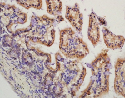 Immunohistochemistry (Formalin/PFA-fixed paraffin-embedded sections) - Anti-HMGCR (phospho S872) antibody (AB215437), expandable thumbnail