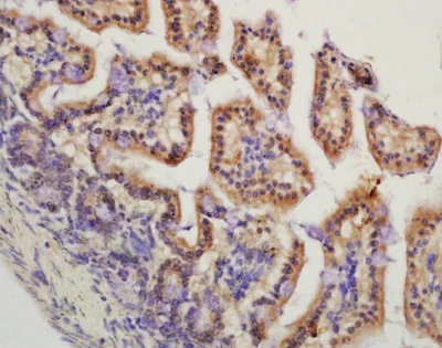 Immunohistochemistry (Formalin/PFA-fixed paraffin-embedded sections) - Anti-HMGCR (phospho S872) antibody (AB215437)