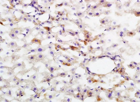 Immunohistochemistry (Formalin/PFA-fixed paraffin-embedded sections) - Anti-HMGCR (phospho S872) antibody (AB215437)