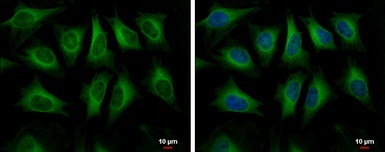 Immunocytochemistry/ Immunofluorescence - Anti-HMGCS1 antibody (AB155787)
