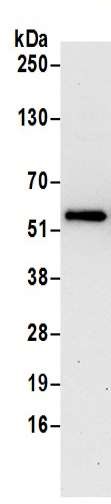 Immunoprecipitation - Anti-HMGCS1 antibody - C-terminal (AB194971), expandable thumbnail