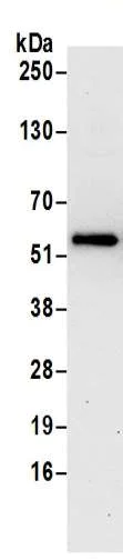 Immunoprecipitation - Anti-HMGCS1 antibody - C-terminal (AB194971)
