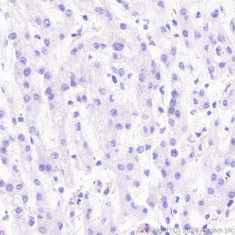 Immunohistochemistry (Formalin/PFA-fixed paraffin-embedded sections) - Anti-HMGCS1 antibody [EPR29166-11] (AB317626)