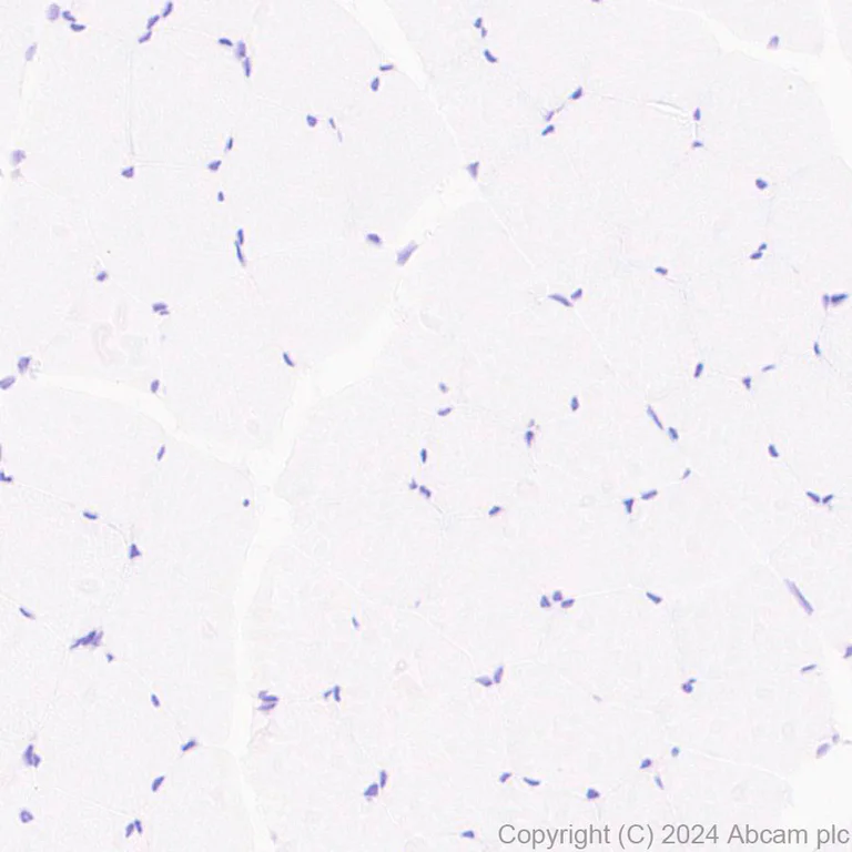 Immunohistochemistry (Formalin/PFA-fixed paraffin-embedded sections) - Anti-HMGCS1 antibody [EPR29166-11] (AB317626)