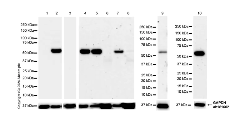 Western blot - Anti-HMGCS1 antibody [EPR29166-11] (AB317626)