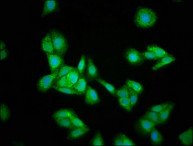 Immunocytochemistry/ Immunofluorescence - Anti-HMGCS2 antibody (AB236667), expandable thumbnail