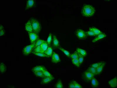 Immunocytochemistry/ Immunofluorescence - Anti-HMGCS2 antibody (AB236667)
