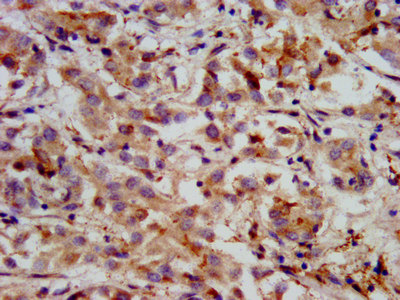 Immunohistochemistry (Formalin/PFA-fixed paraffin-embedded sections) - Anti-HMGCS2 antibody (AB236667), expandable thumbnail