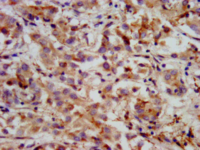 Immunohistochemistry (Formalin/PFA-fixed paraffin-embedded sections) - Anti-HMGCS2 antibody (AB236667)