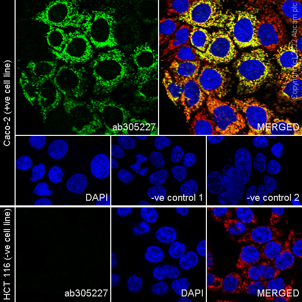 Immunocytochemistry/ Immunofluorescence - Anti-HMGCS2 antibody [EPR26978-39] (AB305227), expandable thumbnail
