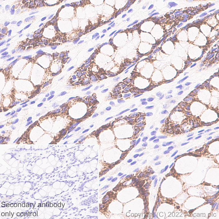 Immunohistochemistry (Formalin/PFA-fixed paraffin-embedded sections) - Anti-HMGCS2 antibody [EPR26978-39] (AB305227)