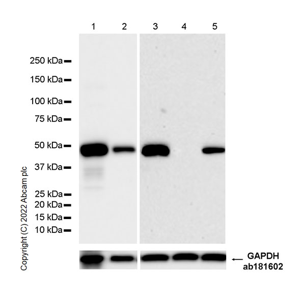 Western blot - Anti-HMGCS2 antibody [EPR26978-39] (ab305227), expandable thumbnail