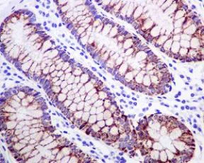 Immunohistochemistry (Formalin/PFA-fixed paraffin-embedded sections) - Anti-HMGCS2 antibody [EPR8642] - BSA and Azide free (AB240099)