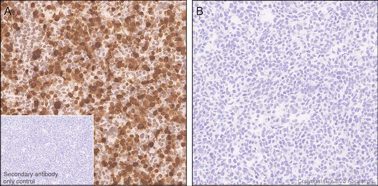 Immunohistochemistry (Formalin/PFA-fixed paraffin-embedded sections) - Anti-HMGN1 antibody [EPR26772-17] (AB314864)