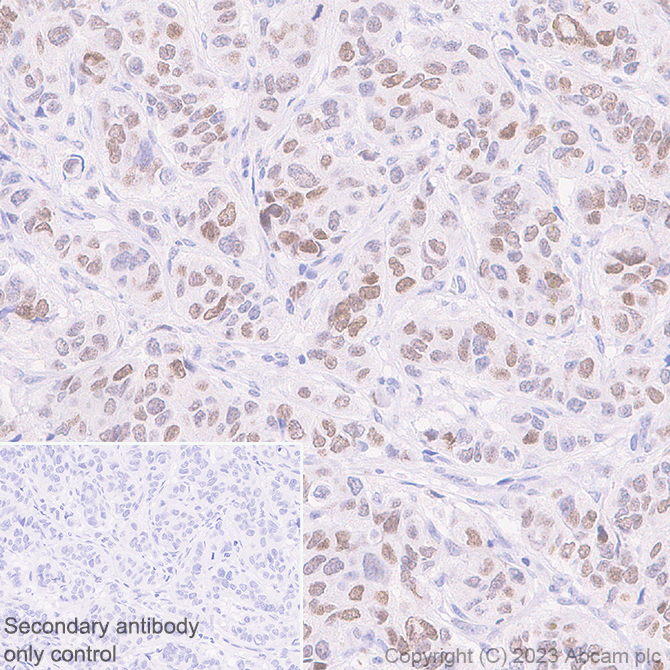 Immunohistochemistry (Formalin/PFA-fixed paraffin-embedded sections) - Anti-HMGN1 antibody [EPR26772-17] - BSA and Azide free (AB314865), expandable thumbnail