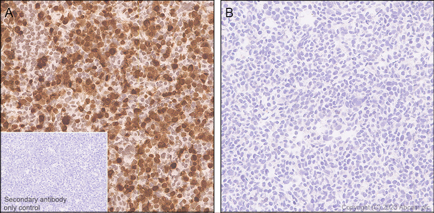 Immunohistochemistry (Formalin/PFA-fixed paraffin-embedded sections) - Anti-HMGN1 antibody [EPR26772-17] - BSA and Azide free (AB314865), expandable thumbnail