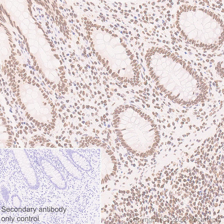Immunohistochemistry (Formalin/PFA-fixed paraffin-embedded sections) - Anti-HMGN1 antibody [EPR27314-67] (AB315889)