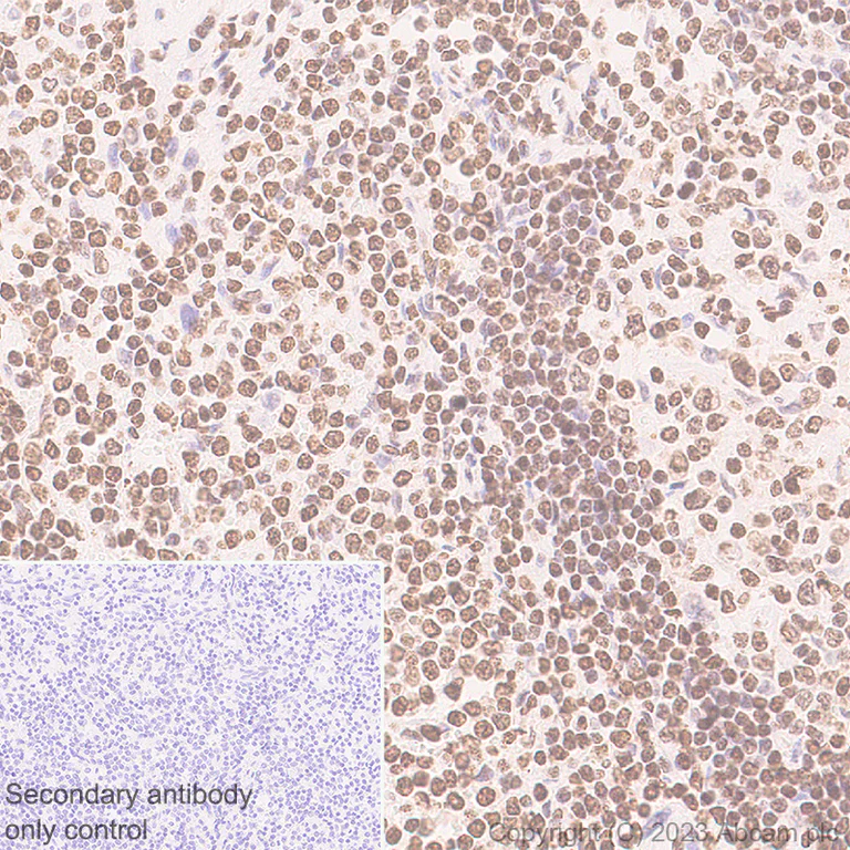 Immunohistochemistry (Formalin/PFA-fixed paraffin-embedded sections) - Anti-HMGN1 antibody [EPR27314-67] (AB315889)
