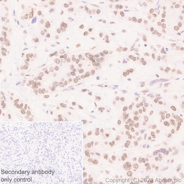 Immunohistochemistry (Formalin/PFA-fixed paraffin-embedded sections) - Anti-HMGN1 antibody [EPR27314-67] (AB315889)