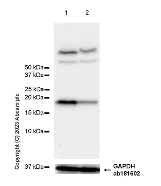 Western blot - Anti-HMGN1 antibody [EPR27314-67] (AB315889)