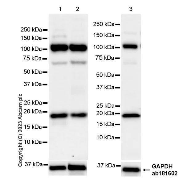 Western blot - Anti-HMGN1 antibody [EPR27314-67] (AB315889)