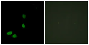Immunocytochemistry/ Immunofluorescence - Anti-HMGN2 antibody (AB117637)