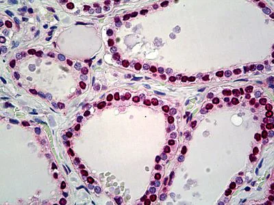 Immunohistochemistry (Formalin/PFA-fixed paraffin-embedded sections) - Anti-HMGN2 antibody (AB117637)