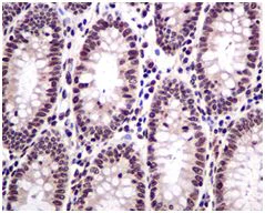 Immunohistochemistry (Formalin/PFA-fixed paraffin-embedded sections) - Anti-HMGN2 antibody [EPR7091] (AB124997)