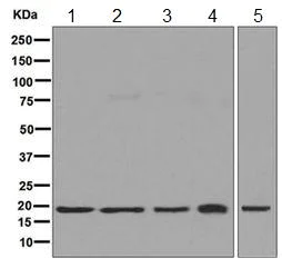 Western blot - Anti-HMGN2 antibody [EPR7091] (AB124997)