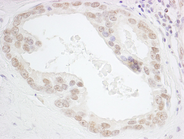 Immunohistochemistry (Formalin/PFA-fixed paraffin-embedded sections) - Anti-HMGN3 antibody (AB72233)