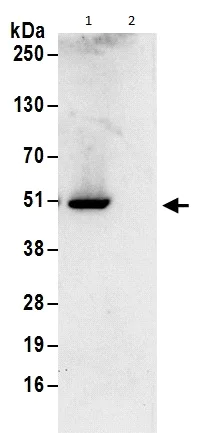 Immunoprecipitation - Anti-HMGN5 antibody (AB186001)