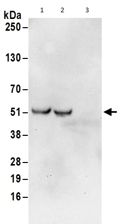 Western blot - Anti-HMGN5 antibody (AB186001)