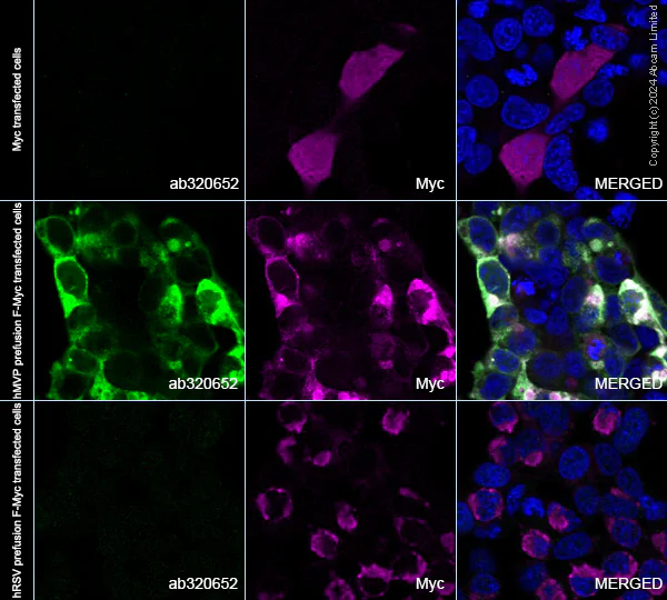 Immunocytochemistry/ Immunofluorescence - Anti-hMPV fusion Protein antibody [EPR29365-579] - BSA and Azide free (AB320653)