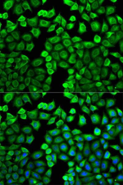 Immunocytochemistry/ Immunofluorescence - Anti-HMT antibody (ab196611), expandable thumbnail