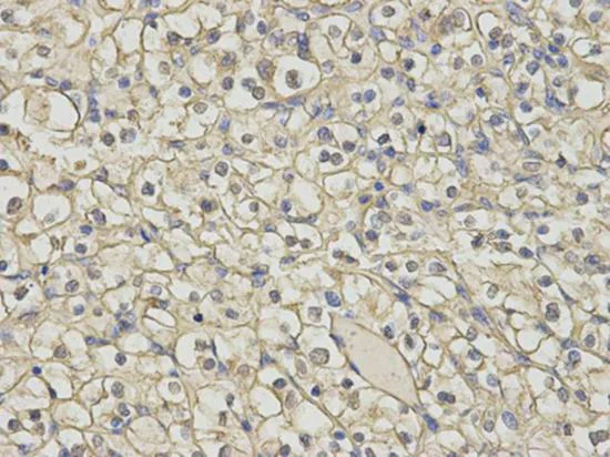 Immunohistochemistry (Formalin/PFA-fixed paraffin-embedded sections) - Anti-HMT antibody (AB196611)
