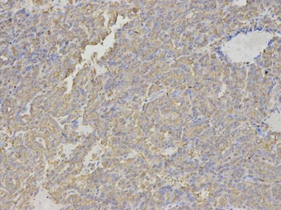 Immunohistochemistry (Formalin/PFA-fixed paraffin-embedded sections) - Anti-HMT antibody (AB196611), expandable thumbnail